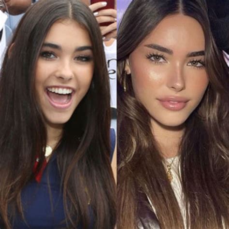 does madison beer have a boob job|The Truth About Madison Beers Plastic Surgery Rumors